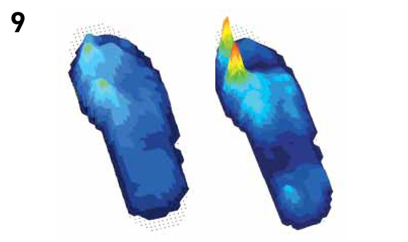 9 - Cartographie des pressions plantaires d'un pied droit avec le port de deux chaussures différentes