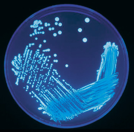 Prélèvements analyses microbiologiques