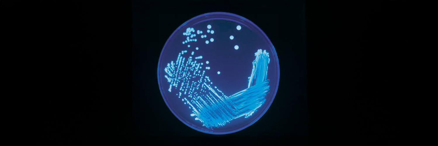 Culture de Legionella sous UV